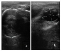 ultrasound images of a horse fetus